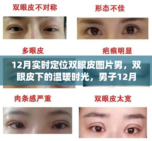 男子雙眼皮恢復之旅，冬季溫暖時光與友情的碰撞