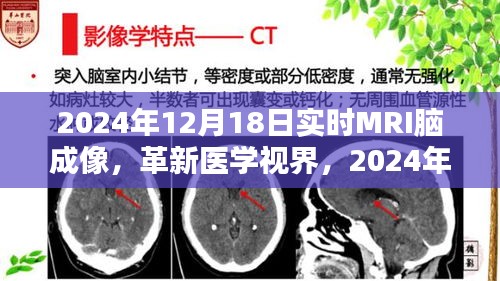 革新醫(yī)學視界，實時MRI腦成像深度評測與未來展望