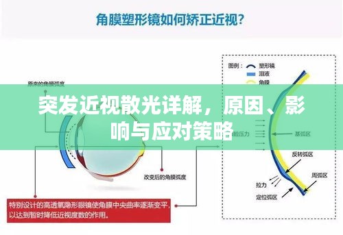 突發(fā)近視散光詳解，原因、影響與應對策略