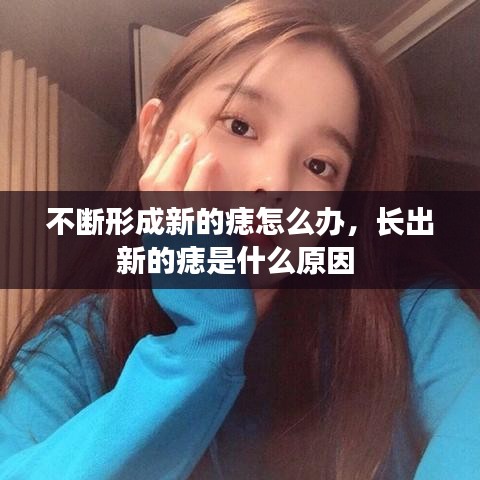 不斷形成新的痣怎么辦，長出新的痣是什么原因 