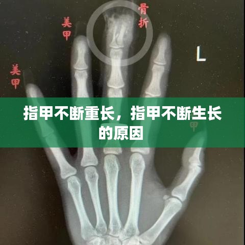 指甲不斷重長，指甲不斷生長的原因 