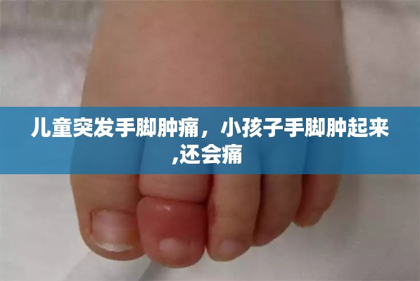 兒童突發(fā)手腳腫痛，小孩子手腳腫起來,還會痛 