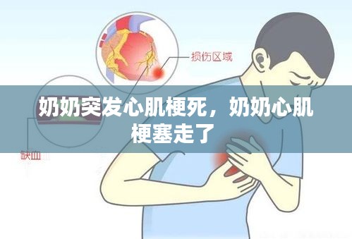 奶奶突發(fā)心肌梗死，奶奶心肌梗塞走了 