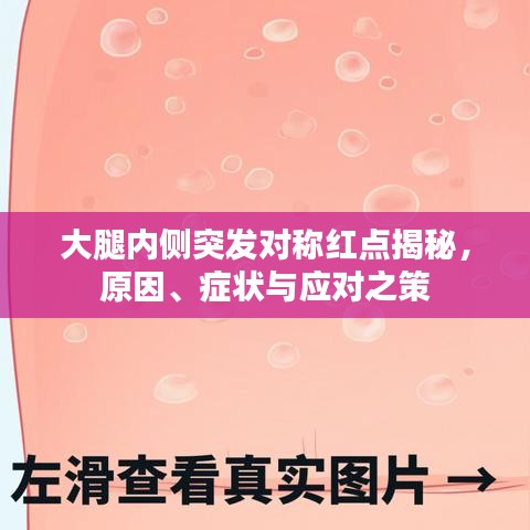 大腿內(nèi)側(cè)突發(fā)對稱紅點揭秘，原因、癥狀與應(yīng)對之策