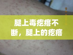 腿上毒疙瘩不斷，腿上的疙瘩特別特別多為什么 