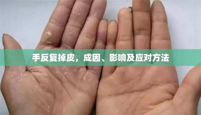 手反復(fù)掉皮，成因、影響及應(yīng)對(duì)方法