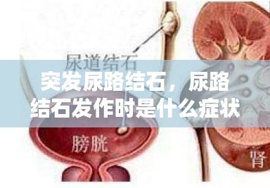突發(fā)尿路結(jié)石，尿路結(jié)石發(fā)作時(shí)是什么癥狀? 