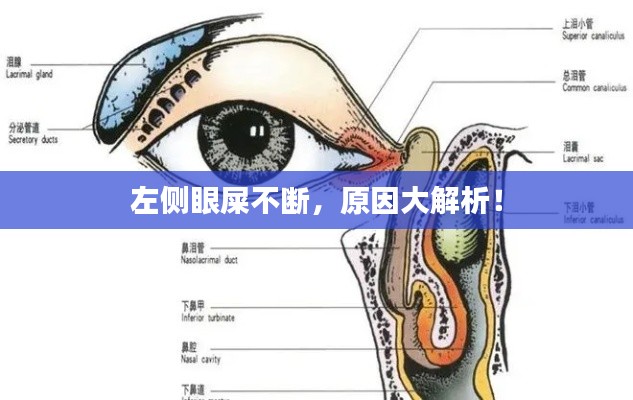 左側(cè)眼屎不斷，原因大解析！
