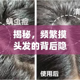 揭秘，頻繁摸頭發(fā)的背后隱藏的故事與心理解讀