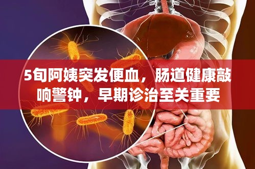 5旬阿姨突發(fā)便血，腸道健康敲響警鐘，早期診治至關(guān)重要