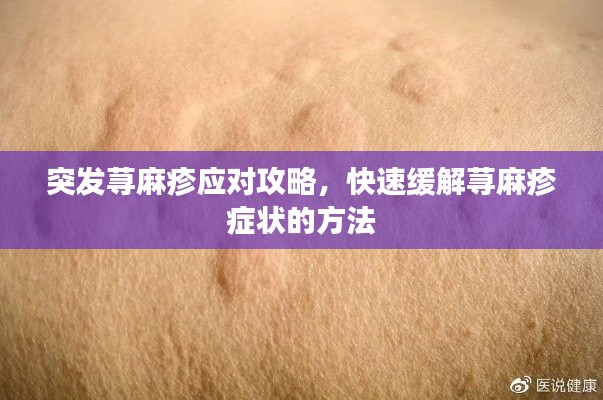 突發(fā)蕁麻疹應對攻略，快速緩解蕁麻疹癥狀的方法
