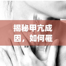 揭秘甲亢成因，如何罹患甲狀腺功能亢進(jìn)？