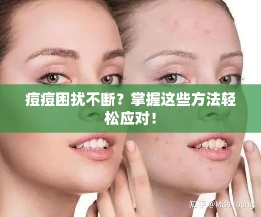 痘痘困擾不斷？掌握這些方法輕松應對！