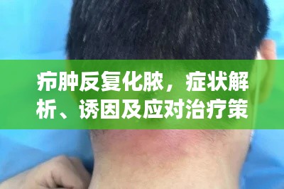 癤腫反復(fù)化膿，癥狀解析、誘因及應(yīng)對(duì)治療策略