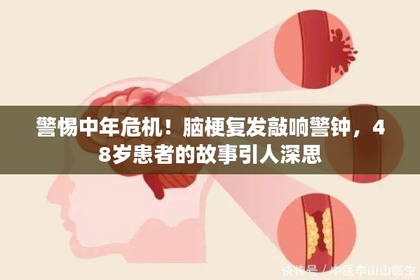 警惕中年危機！腦梗復(fù)發(fā)敲響警鐘，48歲患者的故事引人深思